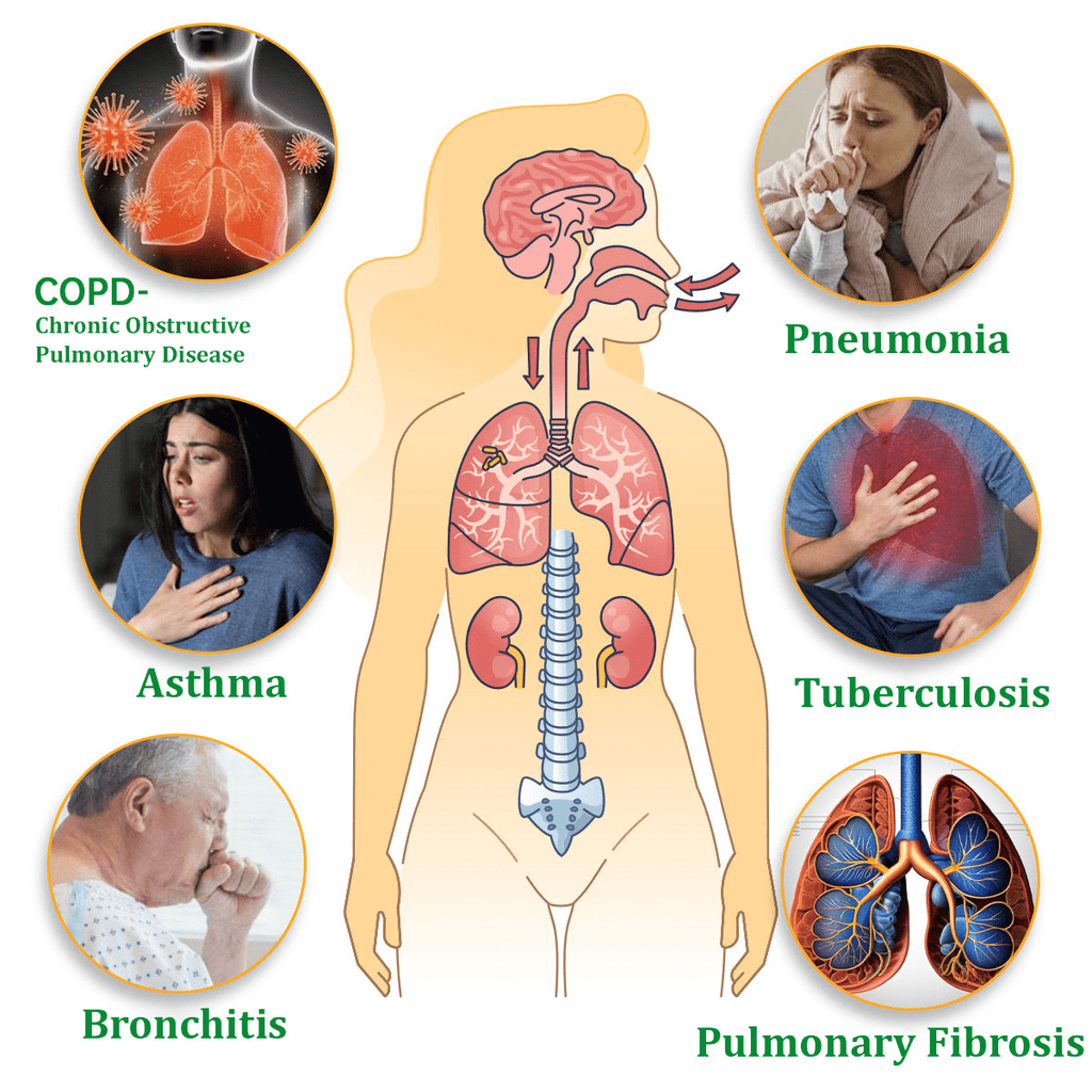💜✅Official Store:Ourlyard® Herbal Lung Cleansing Inhaler👨‍⚕️FDA Certification(💝 Cough, wheezing, shortness of breath, sputum, stuffy nose, bronchitis, bronchitis, allergy symptoms, lung discomfort💝)